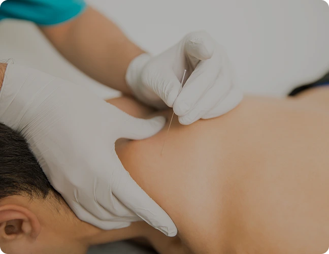 Dry Needling & Soft Tissue Optimization